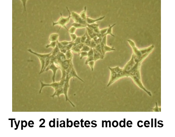 Type 2 diabetes mode cells